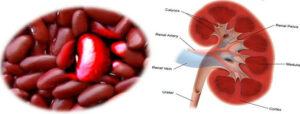 how-to-make-the-perfect-smoothie-image-6-kidney-beans-and-a-kidney-shown-side-by-side-for-likeness-frosted-fusions